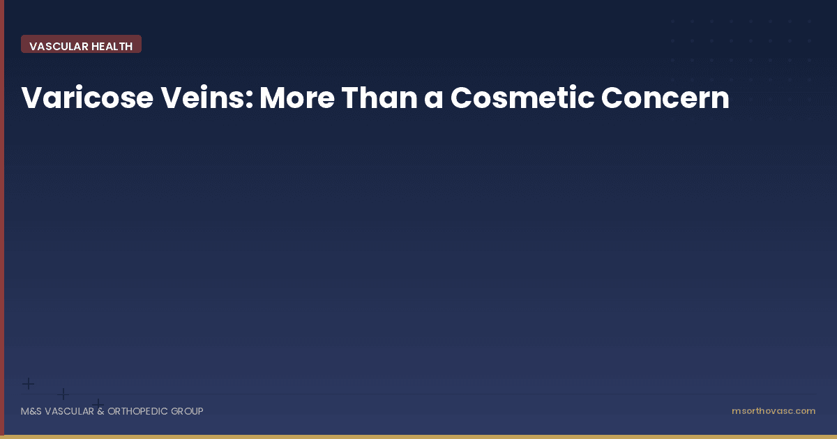 Varicose Veins: More Than a Cosmetic Concern
